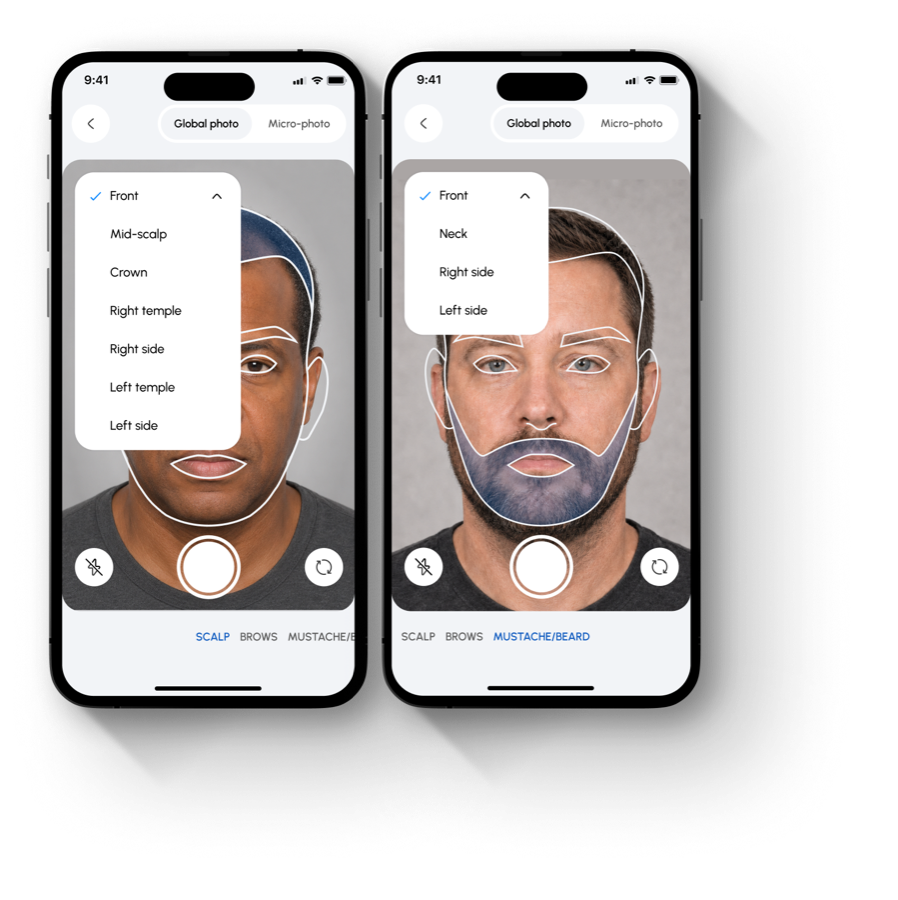 AccuHairate app feature illustration 1