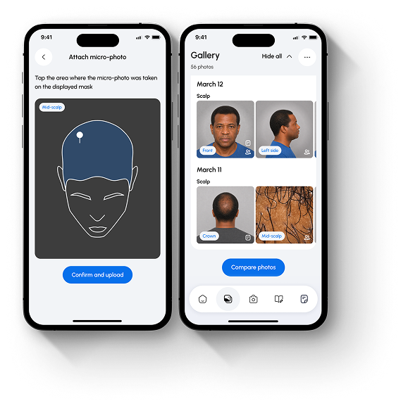 AccuHairate app feature illustration 3